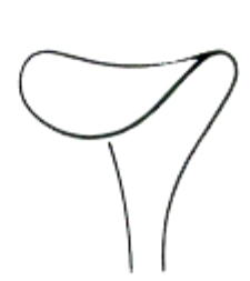 Wound Retractors 16mm 16cm/6 1/4"