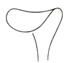 Wound Retractors 18mm 16cm/6 1/4"
