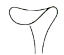 Wound Retractors 14mm 16cm/6 1/4"
